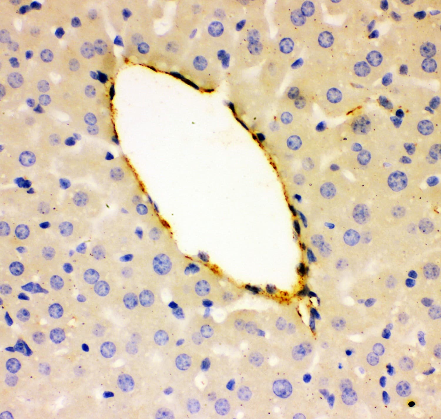 VWF / Von Willebrand Factor Antibody (aa1304-1452)
