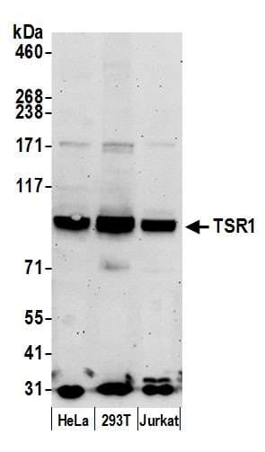 TSR1 Antibody (aa25-75)
