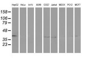 ADH2 / ADH1B Antibody (clone OTI5D7)