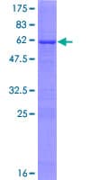 Human ACOT8 Protein (Recombinant GST)