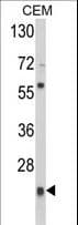 PRDX1 / Peroxiredoxin 1 Antibody (aa88-116)