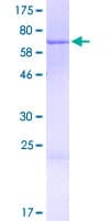 Human CCDC113 Protein (Recombinant GST)
