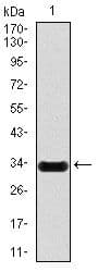 NOS2 / iNOS Antibody (clone 400000)