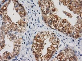 CTH / Cystathionase Antibody (clone OTI1E12, Carrier-free)
