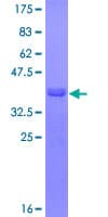 Human CARD9 Protein (Recombinant GST, N-terminus)