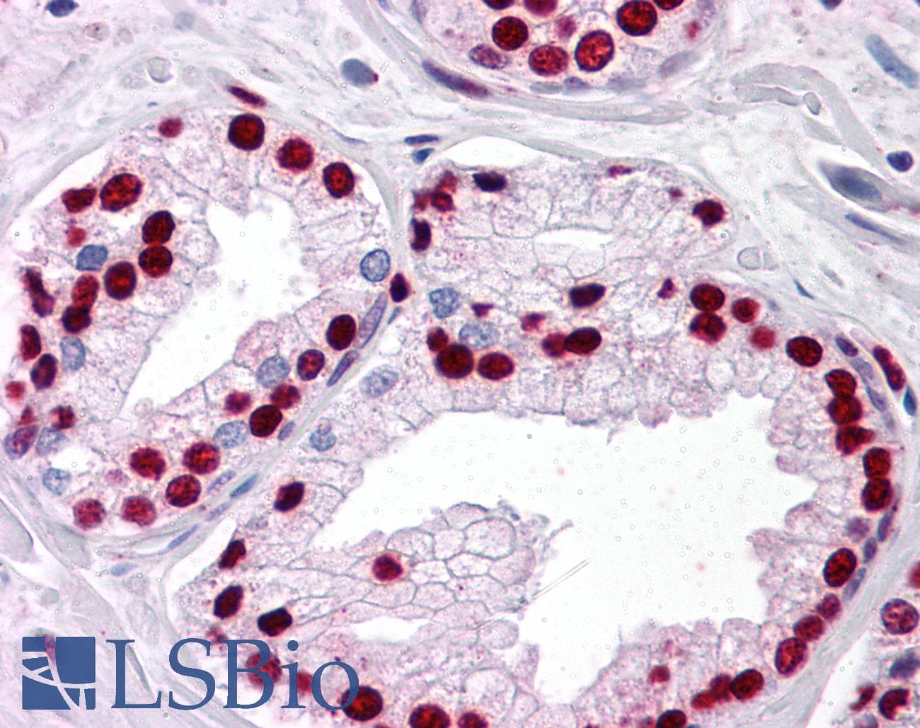 IHC-plus™ SMAD6 Antibody (clone 2A6)