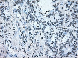 BRAF / B-Raf Antibody (clone OTI4C5)