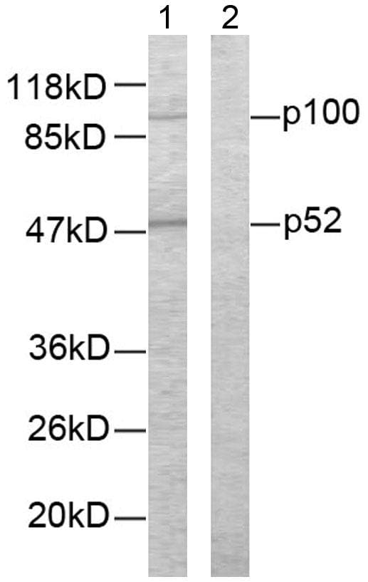 NFKB2 Antibody (p865)