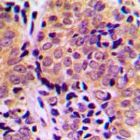 EIF4EBP1 / 4EBP1 Antibody (phospho-Thr46)