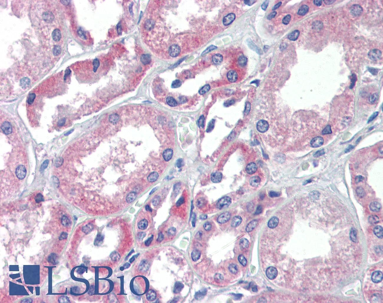 TRIM68 Antibody (aa395-444)