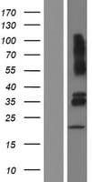 VSIG4 Protein (Over-Expression Lysate Myc-DDK (Flag))