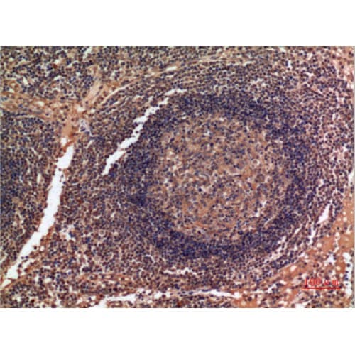 IHC-plus™ ALDH2 Antibody (41-90 aa, N-terminal)