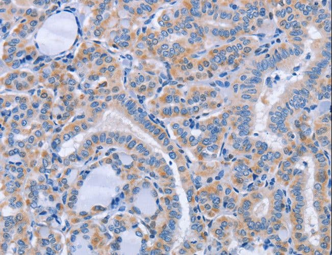 Polyclonal Rabbit anti-Human CD36 Antibody (IHC, WB)