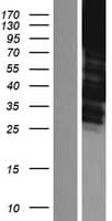 ADD1 / Adducin Alpha Protein (Over-Expression Lysate Myc-DDK (Flag))