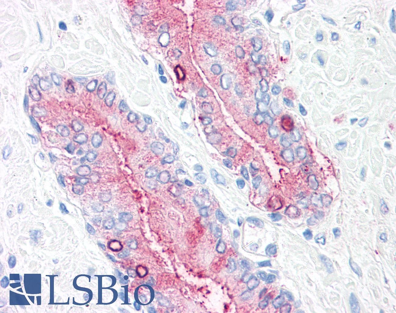 IHC-plus™ Polyclonal Rabbit anti-Human SYNGR2 / Synaptogyrin 2 Antibody (Internal, IHC)