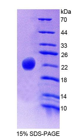 Rabbit HP / Haptoglobin Protein (Recombinant His-T7)