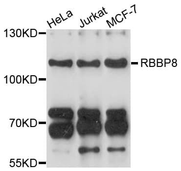 RBBP8 / CTIP Antibody
