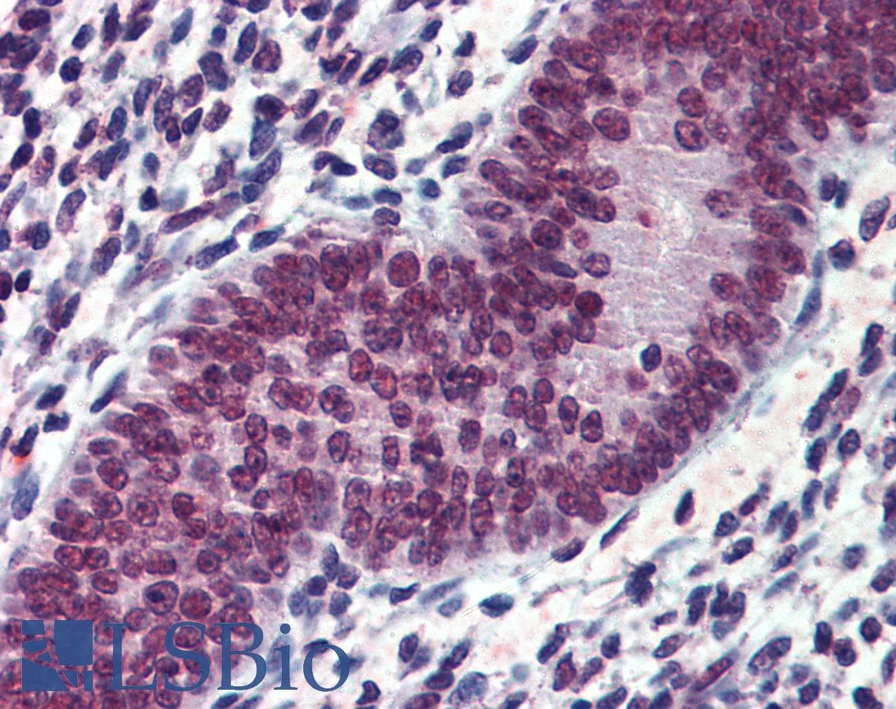 IHC-plus™ Polyclonal Goat anti-Human EWSR1 / EWS Antibody (aa201-215, IHC, WB)