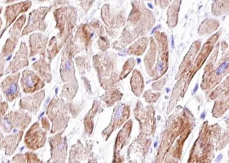 VCL / Vinculin Antibody (phospho-Tyr821)