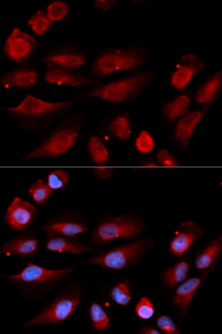 Polyclonal Rabbit anti-Human TP53BP1 / 53BP1 Antibody (IHC, IF, WB)