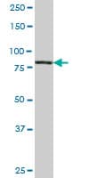 PIK3R1 / p85 Alpha Antibody (clone 3C11)