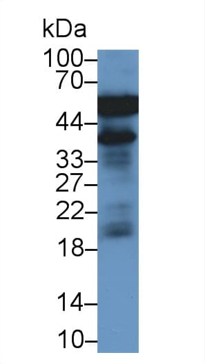 HP / Haptoglobin Antibody (HRP)