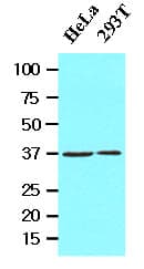 EPM2A / Laforin Antibody (aa243-331, clone K2A3)