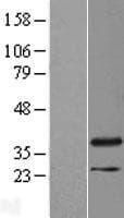 Human RHNO1 / C12orf32 Protein (Over-Expression Lysate Myc-DDK (Flag))