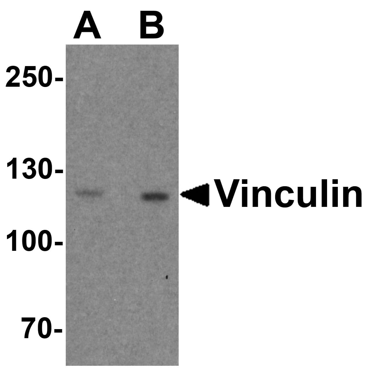 IHC-plus™ VCL / Vinculin Antibody