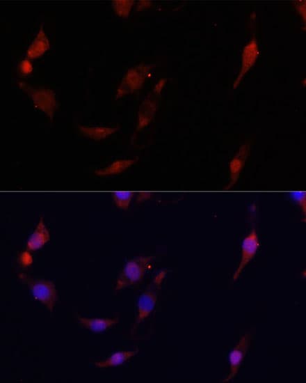 S100A4 / FSP1 Antibody