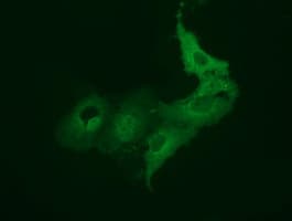 VMD2L3 / BEST3 Antibody (clone OTI1B6)