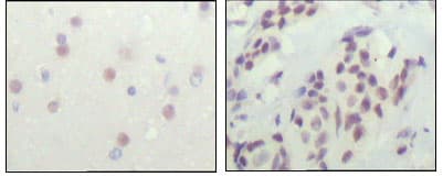 Monoclonal Mouse anti-Human N-CoR / NCOR1 Antibody (clone 7A7A9, IHC, WB)