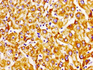 Polyclonal Rabbit anti-Human ECI2 / PECI Antibody (IHC, WB)