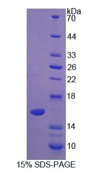 Bovine LALBA / Alpha Lactalbumin Protein (Recombinant His-T7)