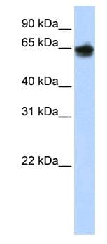 KRT1 / CK1 / Cytokeratin 1 Antibody (C-Terminus)