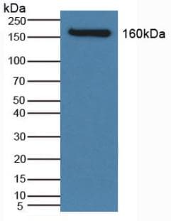 SLC12A3 / TSC Antibody (aa867-1024, APC)