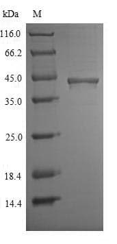 Mouse CHID1 Protein (Recombinant 6His, N-terminus)