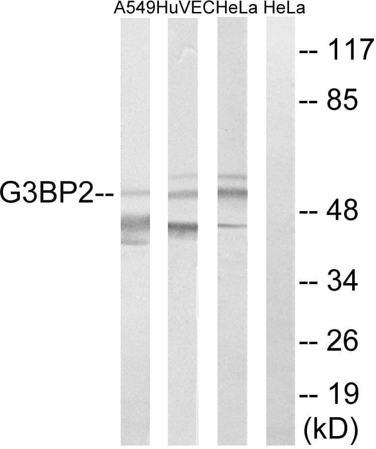 IHC-plus™ Polyclonal Rabbit anti-Human G3BP2 Antibody (aa433-482, IHC, WB)
