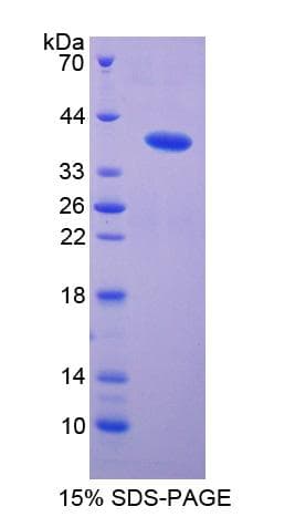 Mouse DEFB4A / BD-2 Protein (Recombinant His-GST)