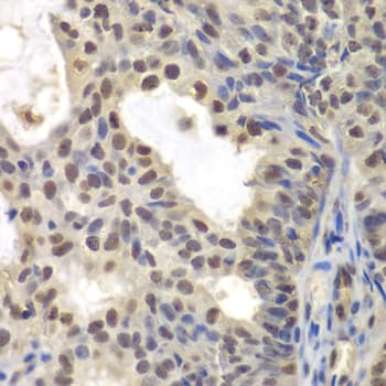 CENPC / CENP-C Antibody
