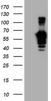 GOLM1 / GP73 / GOLPH2 Antibody (clone OTI2F3)