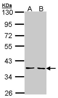 YKL39 / CHI3L2 Antibody (aa27-374)