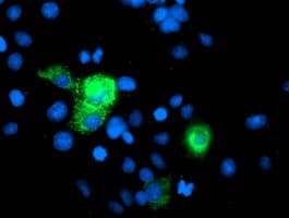 Monoclonal Mouse anti-Human PGAM2 Antibody (clone OTI4B12, IF, WB)