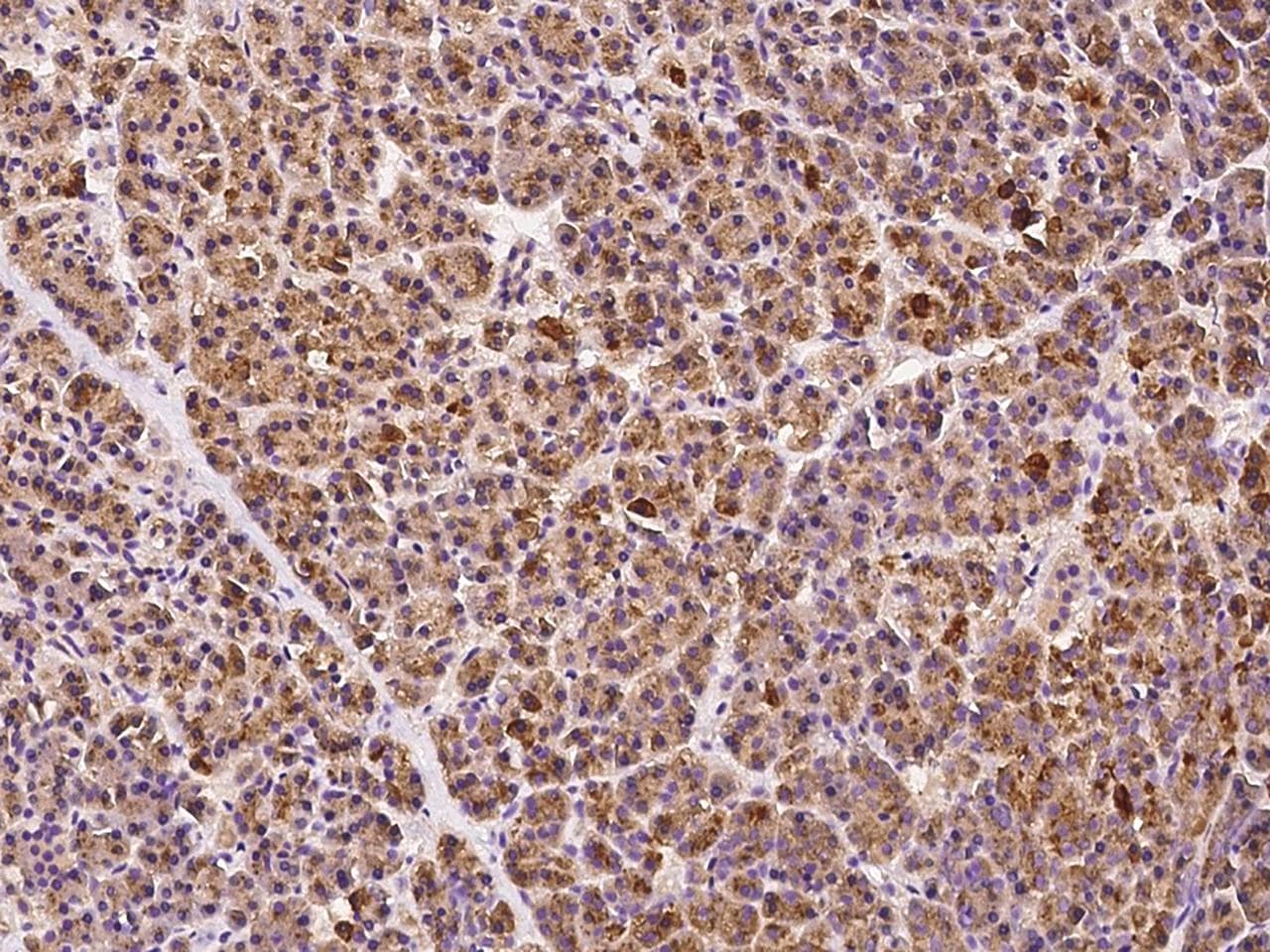 Polyclonal Rabbit anti-Human ALDP / ABCD1 Antibody (IHC, IF)