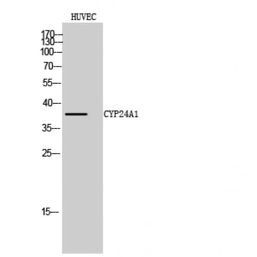 CYP24 / CYP24A1 Antibody (380-460 aa, C-terminal)