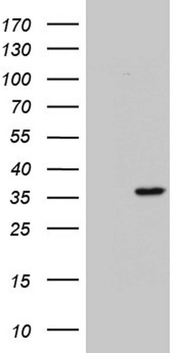 ENKUR Antibody (clone OTI5D4)