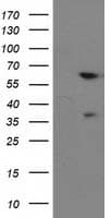 BAIAP2 / IRSP53 Antibody (clone OTI1F4)