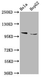 IKBKAP / IKAP Antibody