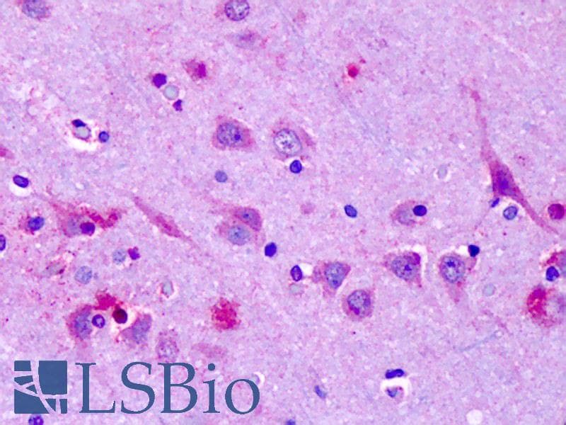 IHC-plus™ OR6N1 Antibody (Extracellular Domain)
