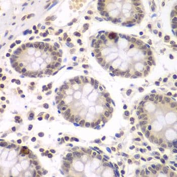 NIRF / UHRF2 Antibody